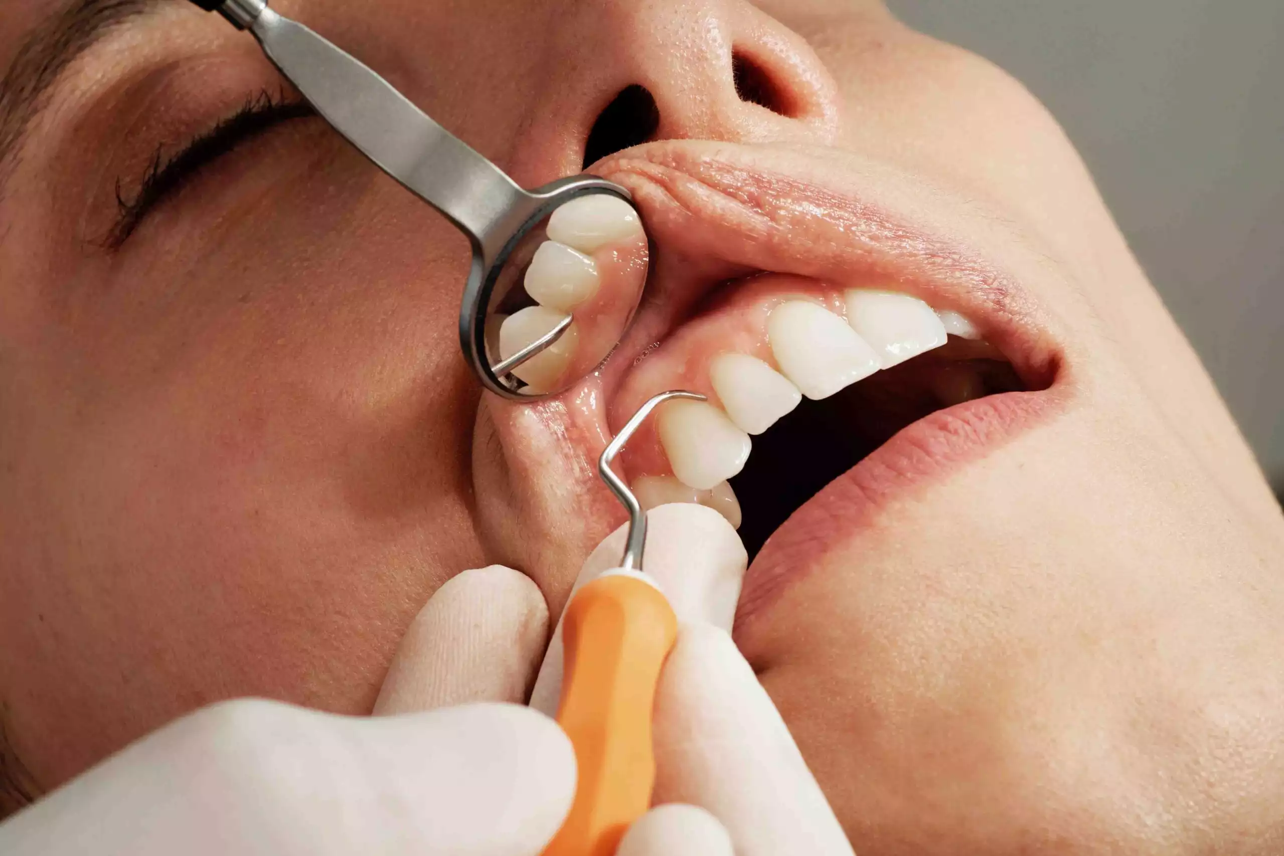 Dental Treatments